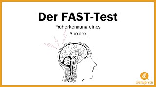 quotFAST Testquot So erkennst du einen Schlaganfall frühzeitig [upl. by Joiner]