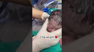 17kg birth weight newborn baby in Nicu  first crying 😢 after the birth  ankur maitrika hospital [upl. by Suisyola]