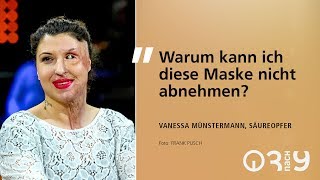 Vanessa Münstermann darüber wie sie sich nach dem SäureAttentat zurück ins Leben kämpfte  3nach9 [upl. by Cesya690]