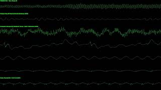 TWINKLE TALE  Boss Theme III Remix By Chiptun3r Tenzen  v09  ZOPICLONE  SIDWIZ [upl. by Roland]