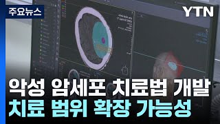 1회 30분이면 치료 끝악성 암세포 잡는다  YTN [upl. by Piefer]