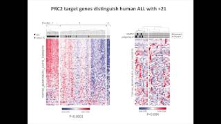 Histone H3K27 Demethylases as a Therapeutic Target in Polysomy 21 Leukemia [upl. by Prosper]