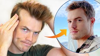 How I Stopped My Receding Hairline Mens Hair Loss Guide [upl. by Ramak]