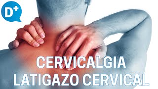 Causas y tratamiento de la cervicalgia y del latigazo cervical [upl. by Liew935]