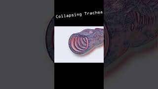 Collapsing Trachea in dogs shorts [upl. by Henri424]