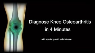 Diagnose Knee Osteoarthritis in 4 Minutes with Leslie Nielsen [upl. by Llechtim611]