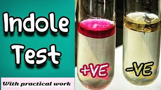 Indole test  Microbiology Microbial Biochemical test [upl. by Hollenbeck]