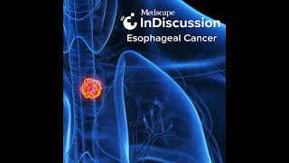 Emerging Biomarkers and Novel Therapies for Esophageal Cancer [upl. by Eeldivad]