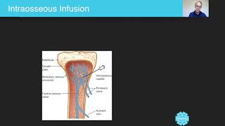 Intraosseous Infusion  Australian Paramedical College [upl. by Hu]