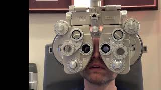 PRESBYOND Laser Blended Vision Tolerance Assessment Emmetropic Patient [upl. by Dominik]