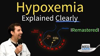 Hypoxemia  The 5 Causes amp Treatment 1 High Altitude [upl. by Hosea114]