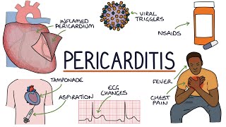 Understanding Pericarditis [upl. by Zosema]