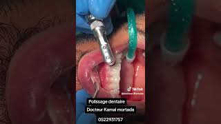 dentist choftv casablanca dentistry chouf doctor chouftvlive shortvideo dentiste [upl. by Alver]