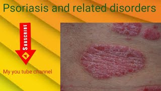 Skin disease psoriasis and related disorders [upl. by Nnylirret514]