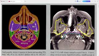 RADIOLOGY EXAM CASES [upl. by Buyse409]