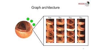 Topological SLAM in colonoscopies leveraging deep features and topological priors Morlana et al [upl. by Aihsein]