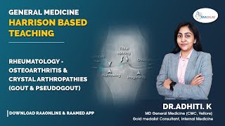 HBT  Rheumatology  Osteoarthritis and crystal arthropathies Gout and Pseudogout  Raaonline [upl. by Chubb29]