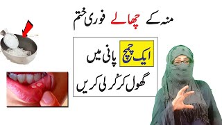 How to get rid of mouth blisters at home  Munh k chalon ka ilaj Anam Home Remedy [upl. by Yeleen]