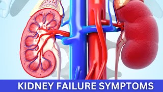 KIDNEY FAILURE Symptoms You Need to Know RIGHT NOW [upl. by Akenihs]