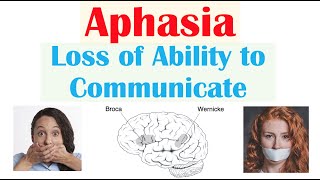 Aphasia  Types Broca’s Wernicke’s Global Causes Signs amp Symptoms Diagnosis Treatment [upl. by Nairadas]