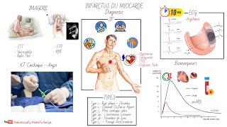 INFARCTUS DU MYOCARDE IDM  PHYSIOPATHOLOGIE ET DIAGNOSTIC [upl. by Acinelav66]