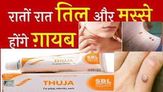 Thuja cream ke fayde in hindi  Thuja Homeopathic Medicine for moles  Thuja ointment  warts cream [upl. by Yht]