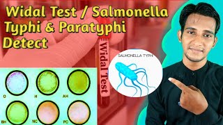 Widal Test Salmonella Typhi and Paratyphi Detect General knowledge for everyone [upl. by Isiad]