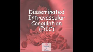 Part 3 Disseminated Intravascular Coagulation DIC [upl. by Ehrman121]