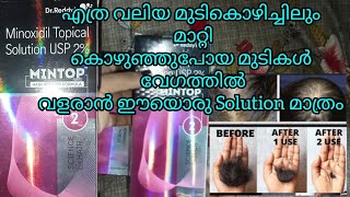 എൻ്റെHair fall story😭 solution Minoxidil Topical Solution 2 Malayalam review hairgrowthhaircare [upl. by Lodmilla]