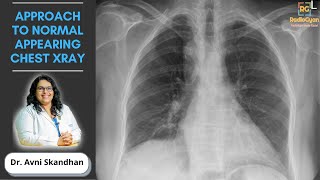 Approach to an Unremarkable Chest XRay  Dr Avni Skandhan [upl. by Delsman]