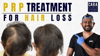 PRP therapy for Hair Loss in IndiaMumbai PRP treatment by DrAsif Cara clinic mumbai PRPforhair [upl. by Perrie]