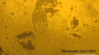 Parasitology Video Balantidium coli in TYIS33 medium  Clip 2 [upl. by Iiette]