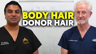 Body Hair As Donor Hair  The Hair Loss Show [upl. by Landau756]