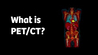 What is PETCT and how does it work [upl. by Glenn]