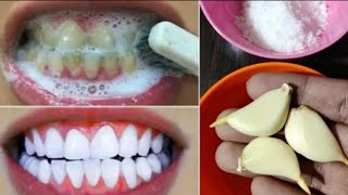 I Tried The Fastest Home Teeth Whitening Methods [upl. by Selden243]