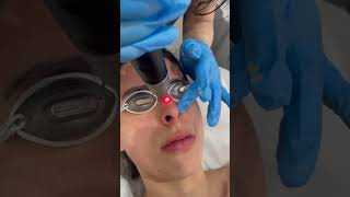 PICOSURE ASMR with Cynosure Picosure Pro skincare manhattanlaserspa [upl. by Akers88]