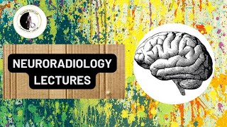 Trigeminal neuralgia  Dr Ahmed ElAgamy [upl. by Nessa643]