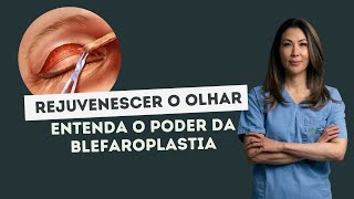 BLEFAROPLASTIA Conheça a cirurgia de pálpebras [upl. by Acinorehs187]