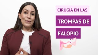 ¿La cirugía soluciona los problemas en las trompas de Falopio [upl. by Nylg]