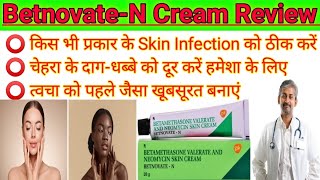 BetnovateN। BetnovateN Skin cream review 2023। How to uses betnovate n skin cream on face। [upl. by Alvin665]