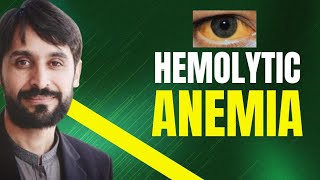 Hemolytic Anemia  Causes  Symptoms  Diagnosis and Treatment  MLT Hub with kamran [upl. by Aerdnek]