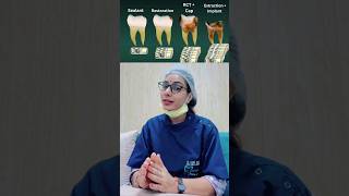 Big cavities big cost  toothdecay dentaltips cavities [upl. by Hedaza]