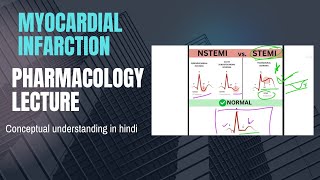 Treatment of myocardial infarction Pharmacology lectures [upl. by Swords534]