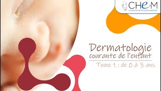 Dermatologie courante de l’enfant de 0 à 3 ans tome 1 [upl. by Hallie]