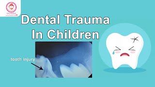 Traumatic Dental Injuries in Pediatric Patients Dental Trauma in Children [upl. by Erlene]