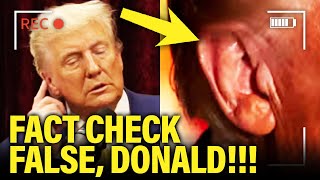 Trump SO CALLED EAR INJURY Claim BACKFIRES in His FACE [upl. by Flatto]