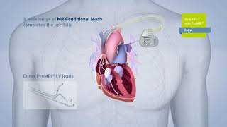 Biotronik pacemaker EVIA [upl. by Palestine135]