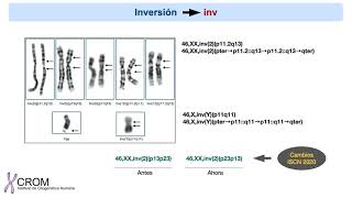 Nomenclatura para las anomalías cromosómicas estructurales [upl. by Fauver]