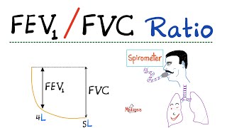 FEV1 FVC Ratio  Pulmonary Medicine  Obstructive VS Restrictive Lung Disease  Respiratory Physio [upl. by Llemart]