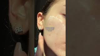 Obsessed 🤭 using a drying powder to instantly reduce my post acne red marks acne shorts dani [upl. by Airotkiv]